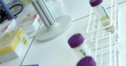 Do we need a European Innovation Union?